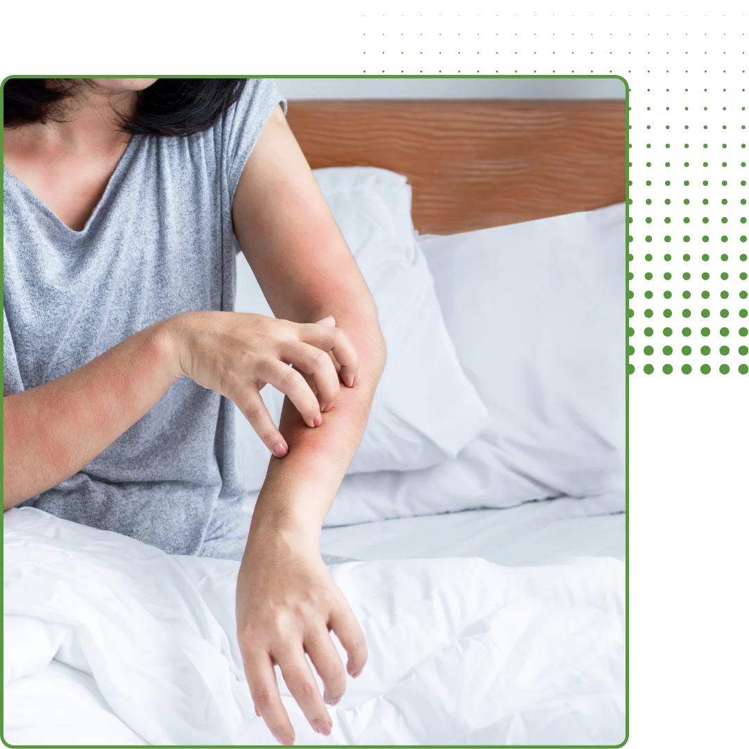 bedbug pest control service